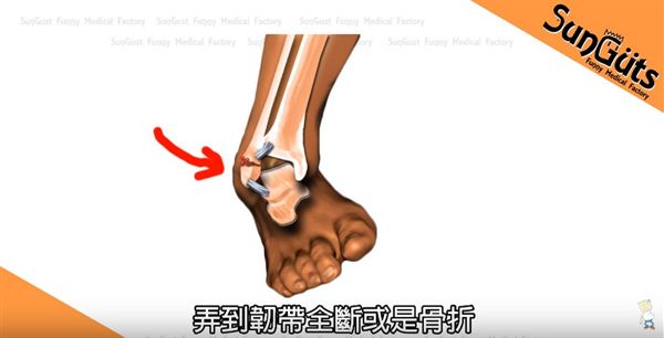 关于季后赛带伤作战！杰威接受右手韧带撕裂修复手术的信息